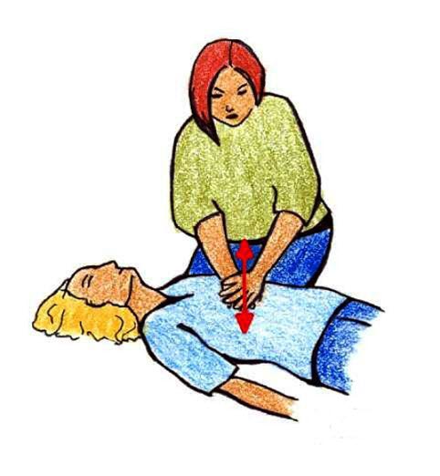 Hjertekompresjon Hjertekompresjon