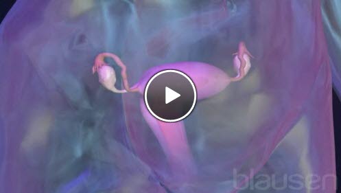 fjerning av eggstokk fjerning av eggstokk