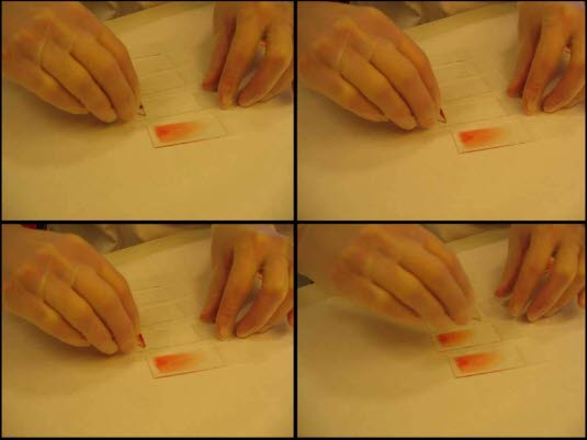 Blodutstryk Blodutstryk