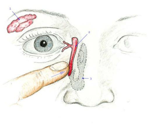 Illustrasjon av tåreveiene og tåreproduserende kjertel