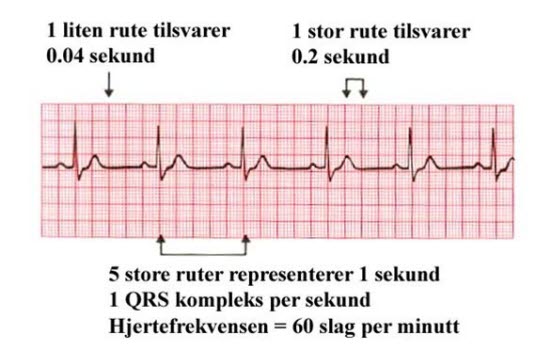 EKG hastighet