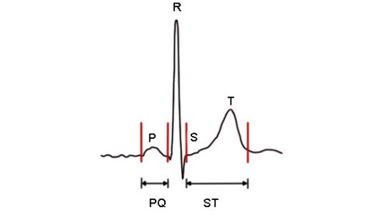 Ekg-signalet Ekg-signalet