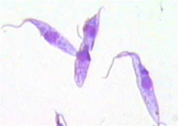 Trypanosoma cruzi Trypanosoma cruzi