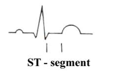ST-segment