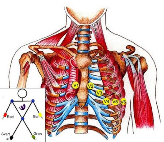 Plassering av elektrodene ved EKG-taking