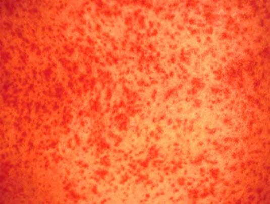 Legemiddelreaksjon 2