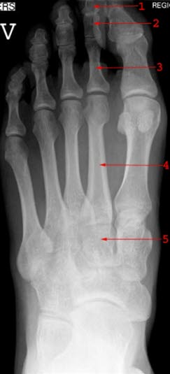 Normalt røntgenbilde