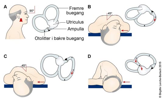 Fremgangsmåte Epleys manøver.