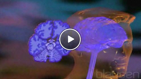 Alzheimers sykdom Alzheimers sykdom