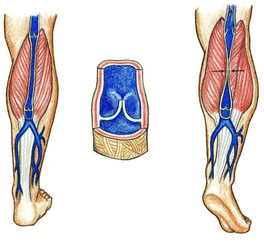 Venepumpen i leggene
