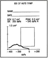 Tympanogram, serøs otitt med luftblærer