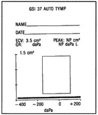 Tympanogram, perforert trommehinne