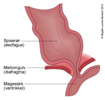 Lukkemuskel i spiserøret Lukkemuskel i spiserøret