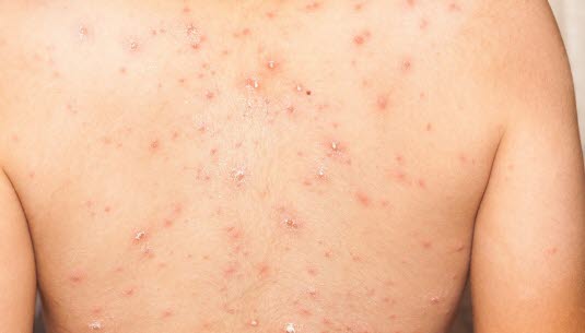 Vannkopper Vannkopper