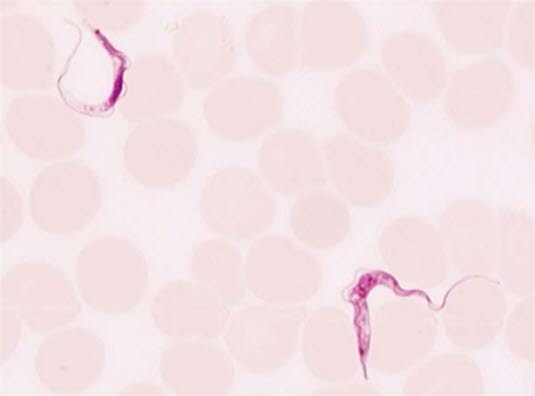 Trypanosoma parasitt. Blodutstryk fra en pasient med Trypanosomiasis brucei rhodesiense