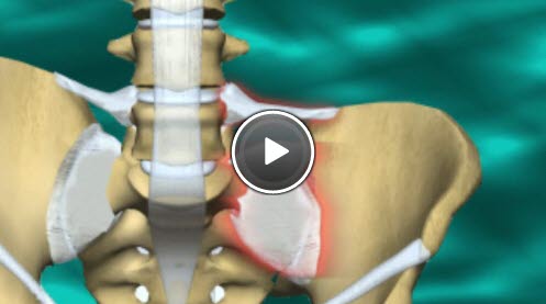 bekkenløsning bekkenløsning
