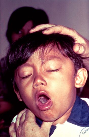 Astma hos barn Astma hos barn