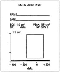 Tympanogram, serøs otitis media Tympanogram, serøs otitis media