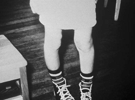 Rakitt. Fra US Centers for Disease Control and Prevention.