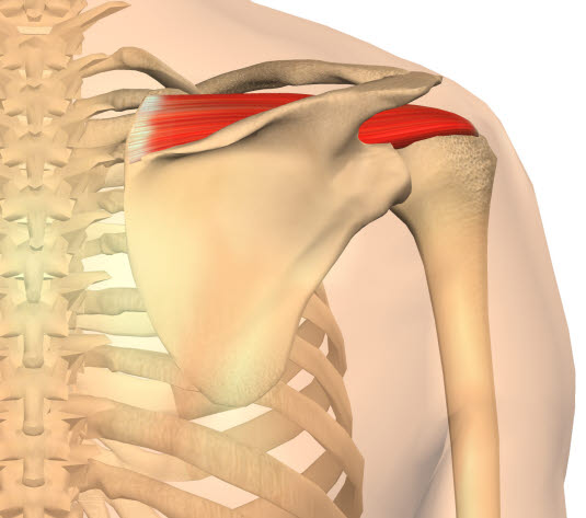 Supraspinatus, muskel og sene Supraspinatus, muskel og sene