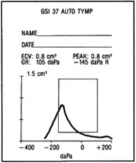 Tympanogram, tuba Eustachi, delvis blokkert Tympanogram, tuba Eustachi, delvis blokkert