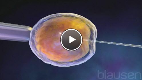 kunstig befruktning kunstig befruktning