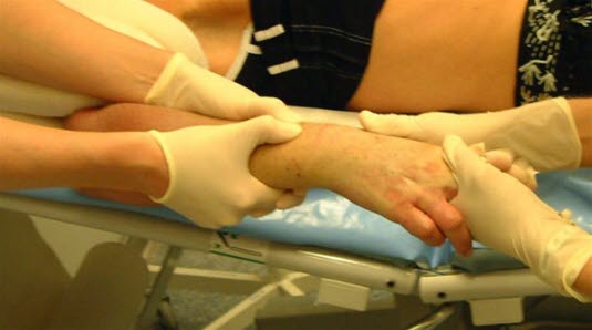 Radiusbrudd, reponering Radiusbrudd, reponering