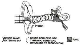 Tympanometer sender lydbølger