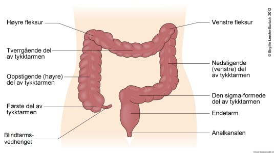 Tykktarmen Tykktarmen