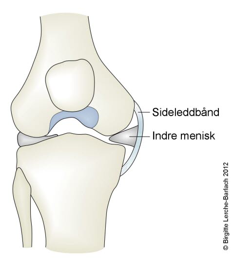 Kne, mediale kollateral ligament