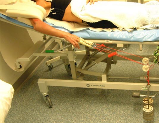 Radiusbrudd, strekk Radiusbrudd, strekk