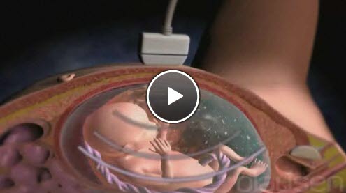 ultralyd i svangerskapet ultralyd i svangerskapet