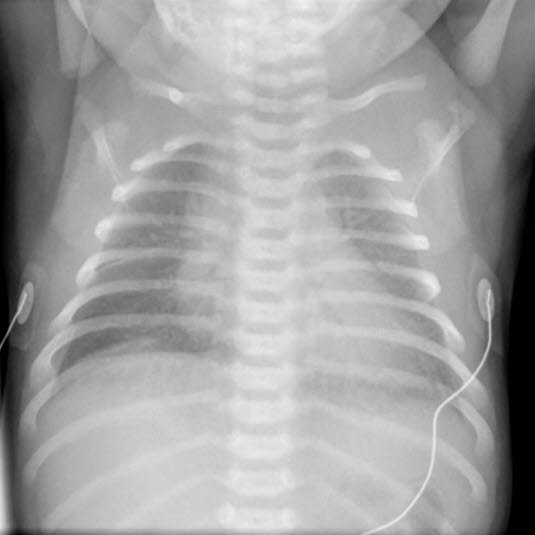 Reprinted from Auckland District Health Board